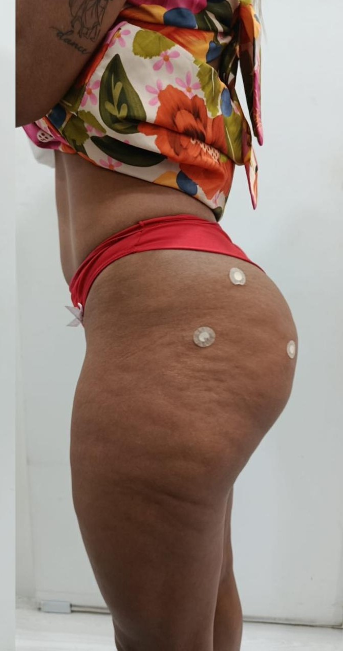 Depois - Mais volume e definição natural